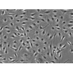 Human Lung Microvascular Endothelial Cells (HLMVEC)